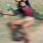 উখিয়া সীমান্তে ফের মাইন বিস্ফোরণে রোহিঙ্গা যুবকের পা বিচ্ছিন্ন